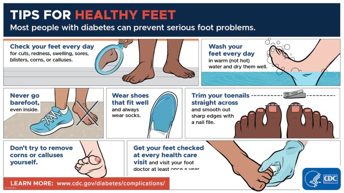Foot diabetes care guide diabetic feet food hygiene chart health mellitus posters treatment footcare checks daily people education get tips