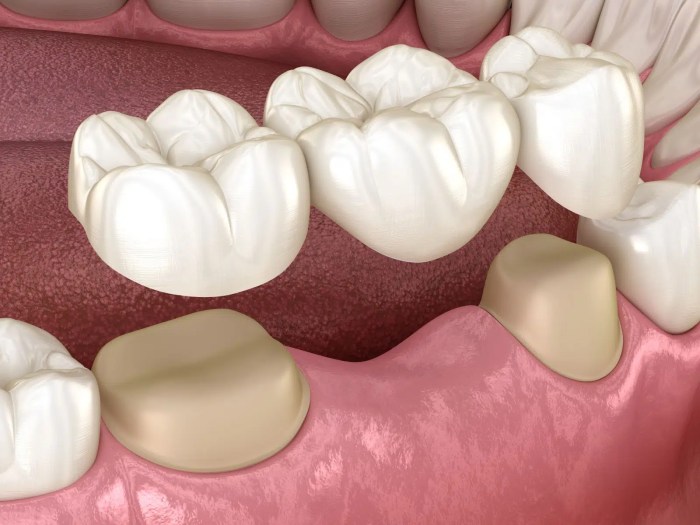 Cosmetic dentistry procedures