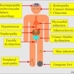 Diabetes complications prevention